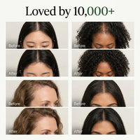 Relevo Korean Scalp Revival Bar - customer results